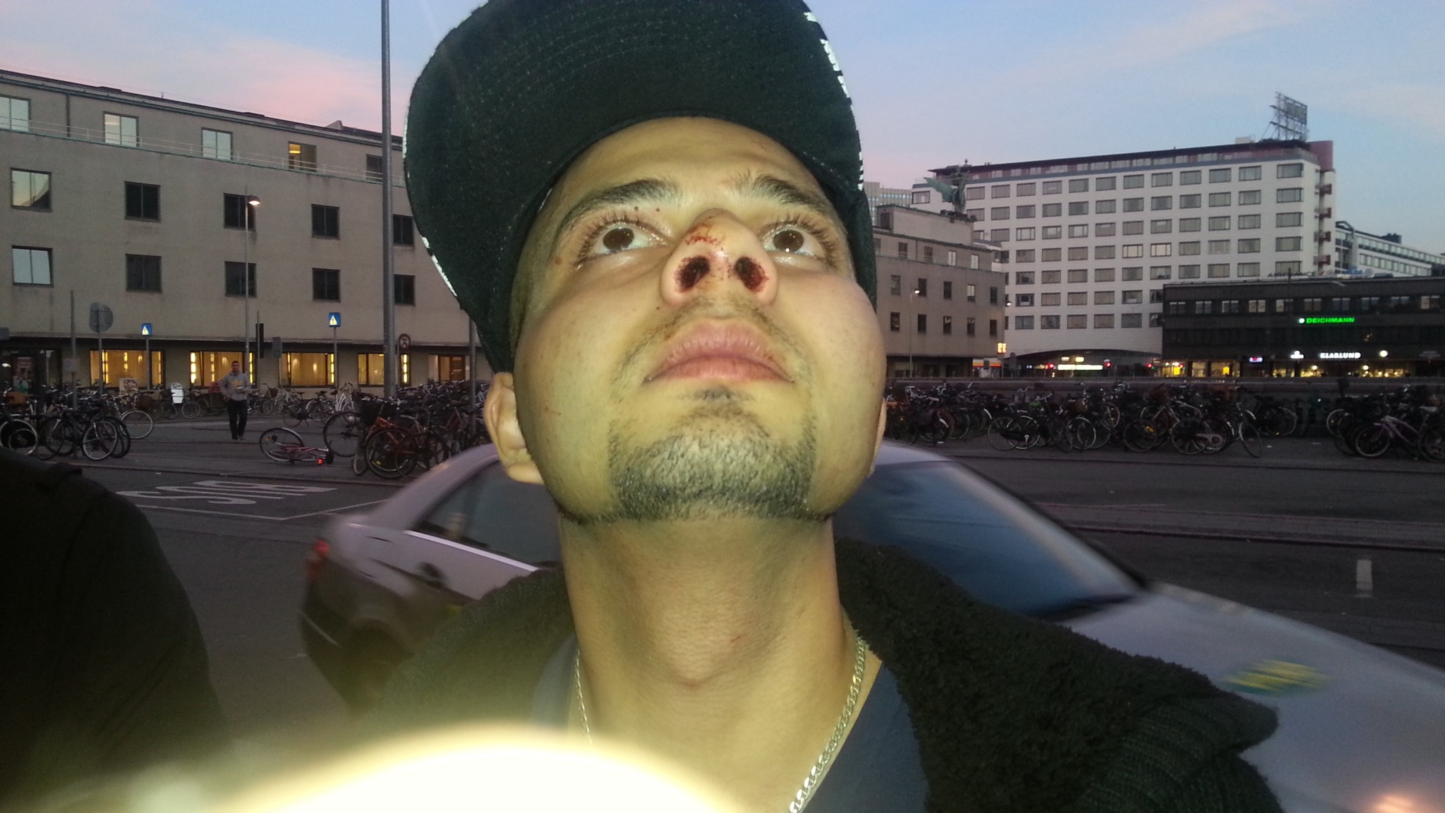 JUSTITS: Racistisk overfaldsmand brækkede hans næse. Politiet kvitterede med en bøde