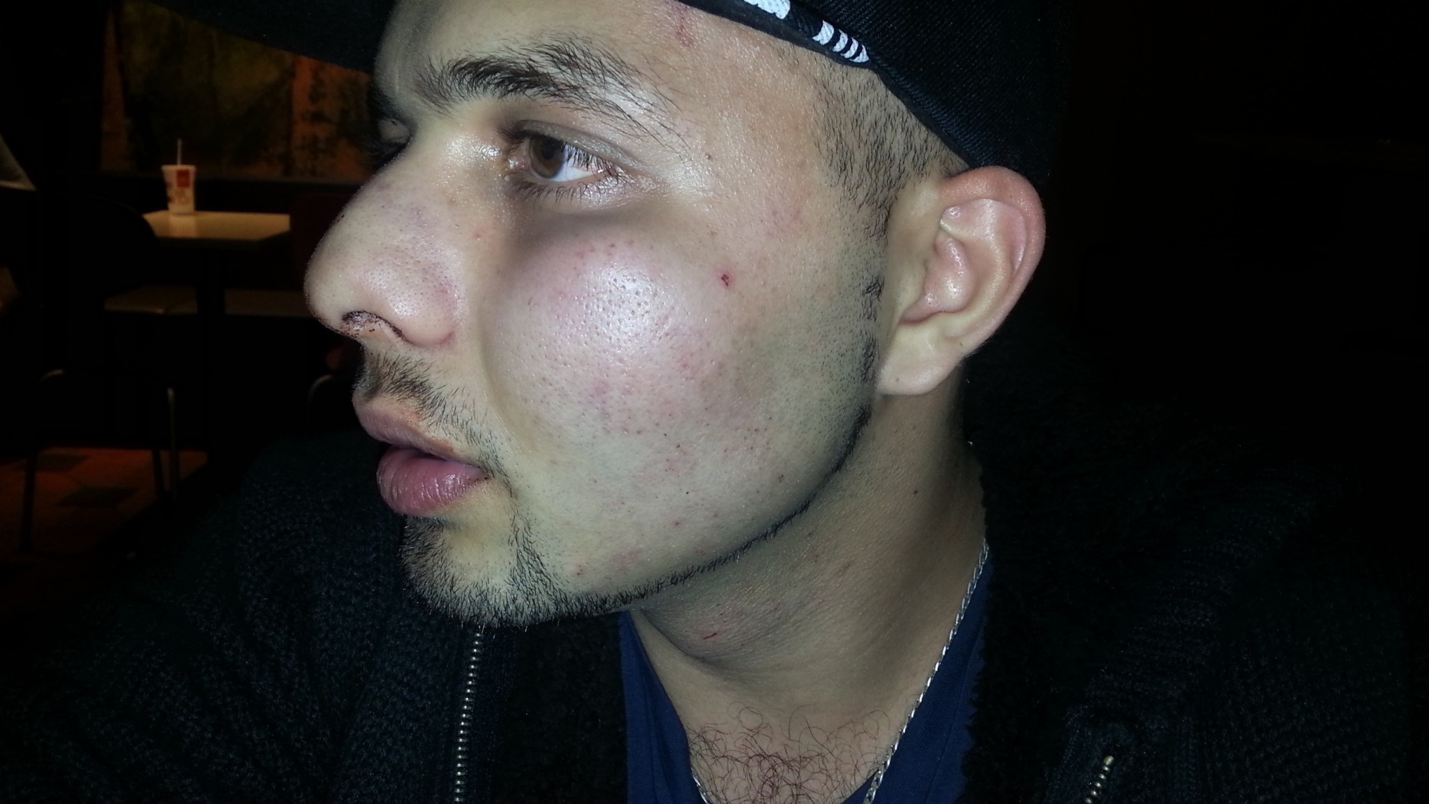 JUSTITS: Racistisk overfaldsmand brækkede hans næse. Politiet kvitterede med en bøde